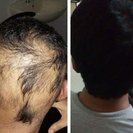 Client-provided before and after hair photograph 1