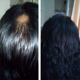 Client-provided before and after hair photograph 3