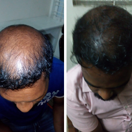 Client-provided before and after hair photograph 4