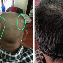 Client-provided before and after hair photograph 5