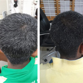 Client-provided before and after hair photograph 6