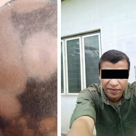 Client-provided before and after hair photograph 7